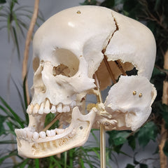 Exploded Human Skull, Beauchene (Collapsible)