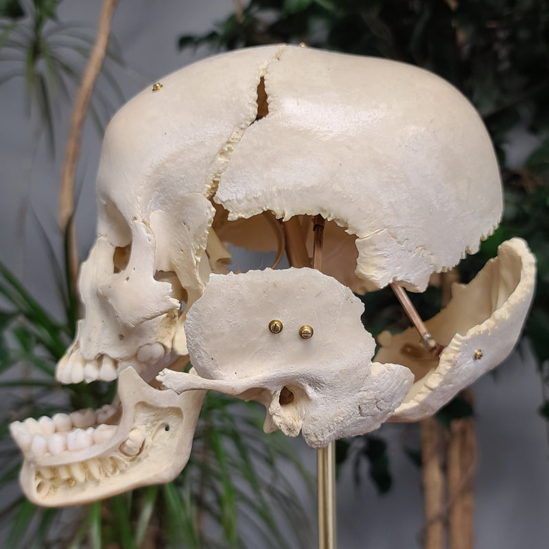 Exploded Human Skull, Beauchene (Collapsible)