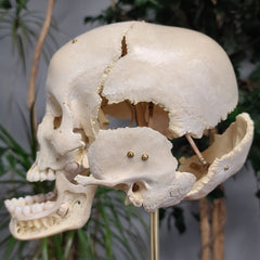 Exploded Human Skull, Beauchene (Collapsible)
