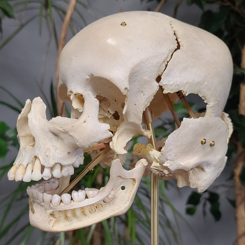 Exploded Human Skull, Beauchene (Collapsible)