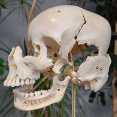 Exploded Human Skull, Beauchene (Collapsible)