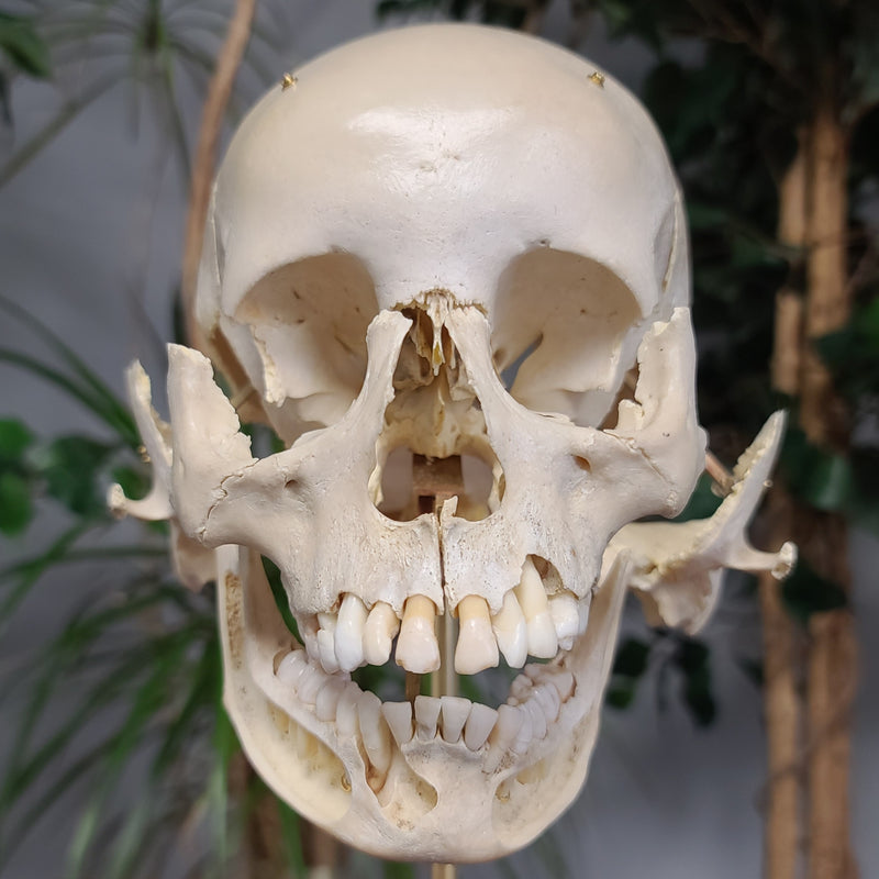 Exploded Human Skull, Beauchene (Collapsible)