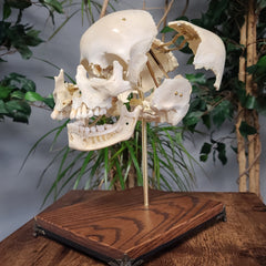 Exploded Human Skull, Beauchene (Collapsible)