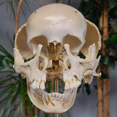 Exploded Human Skull, Beauchene (Collapsible)