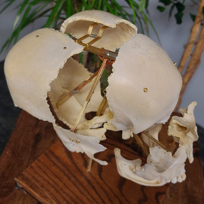 Exploded Human Skull, Beauchene (Collapsible)