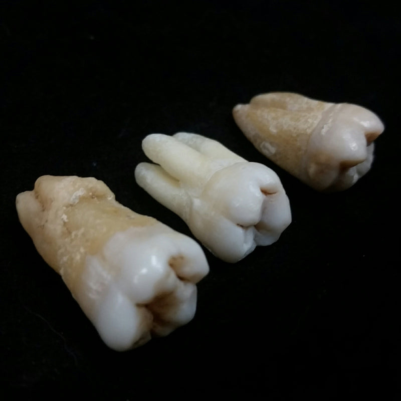 Human Teeth, Molars