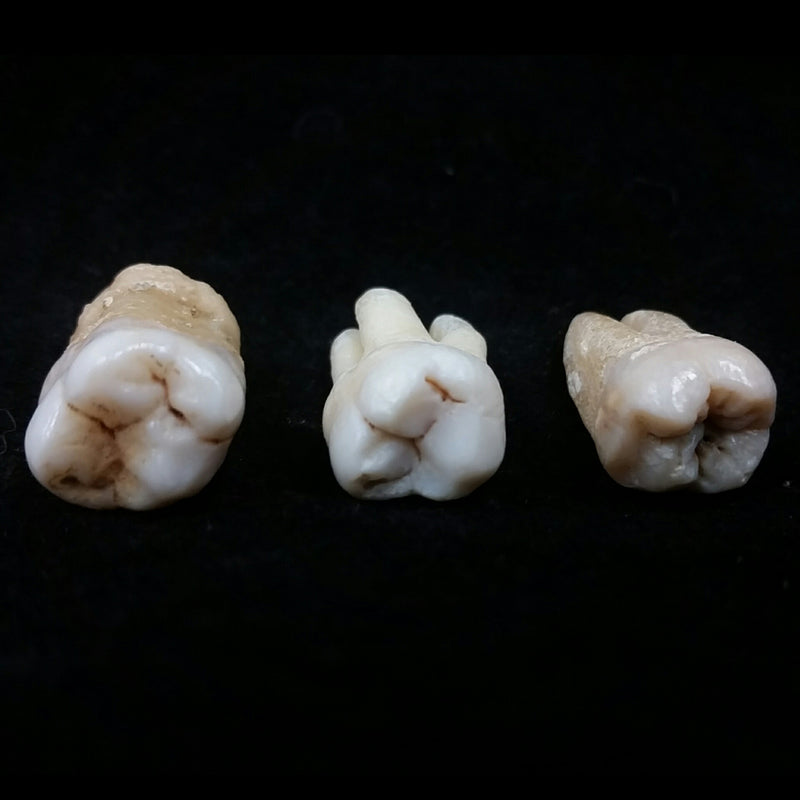 Human Teeth, Molars