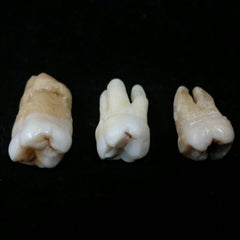 Human Teeth, Molars