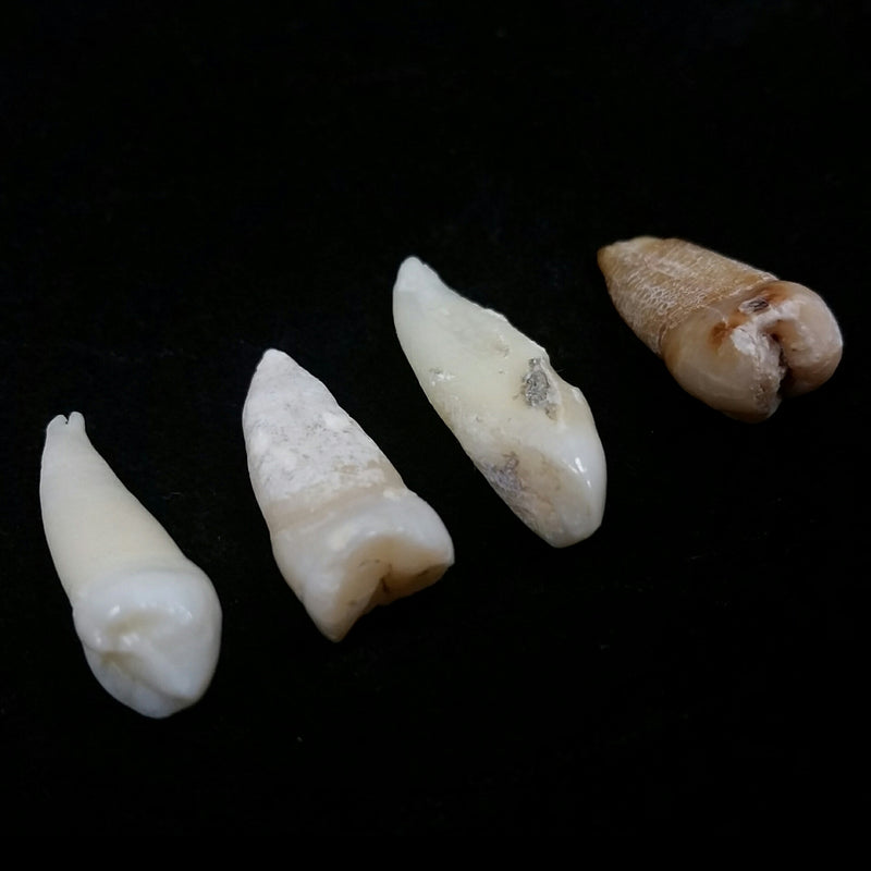 Human Teeth, Assorted