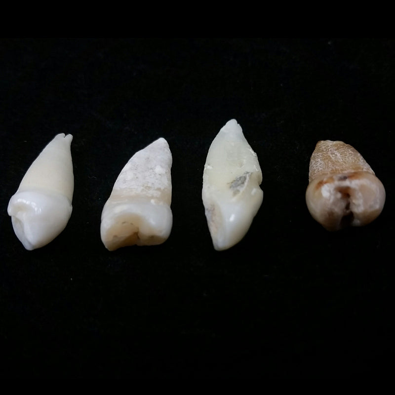 Human Teeth, Assorted