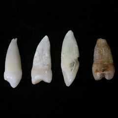 Human Teeth, Assorted