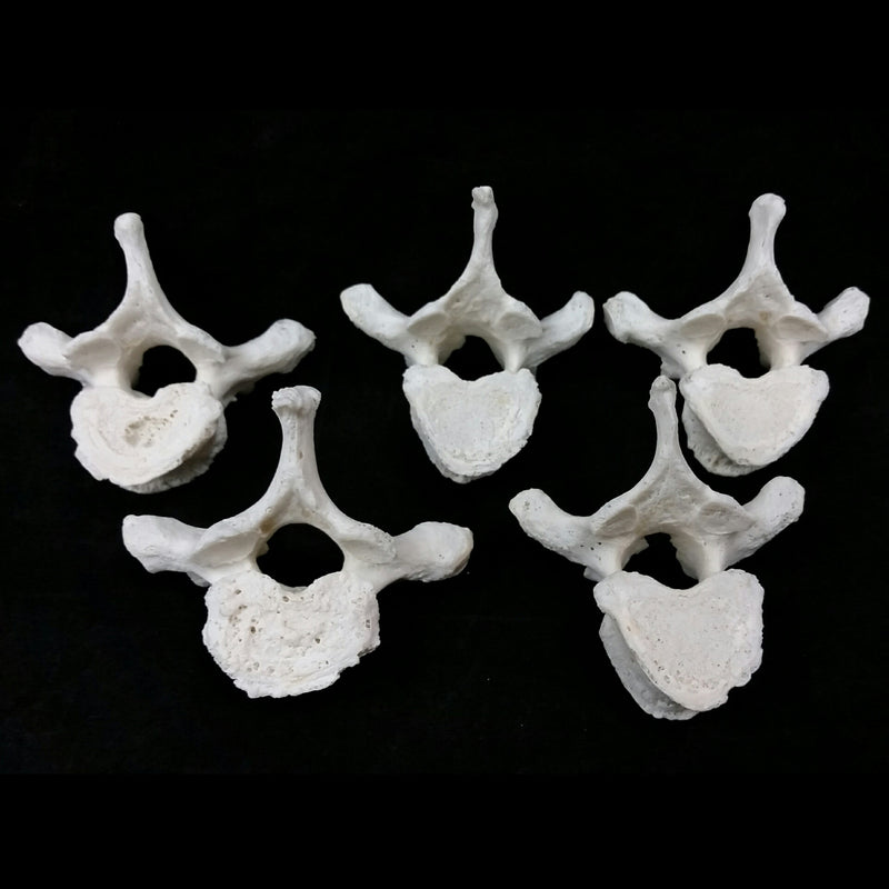 Human Vertebrae, Cervical & Thoracic