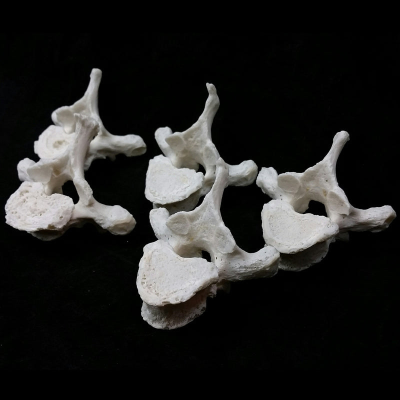 Human Vertebrae, Cervical & Thoracic