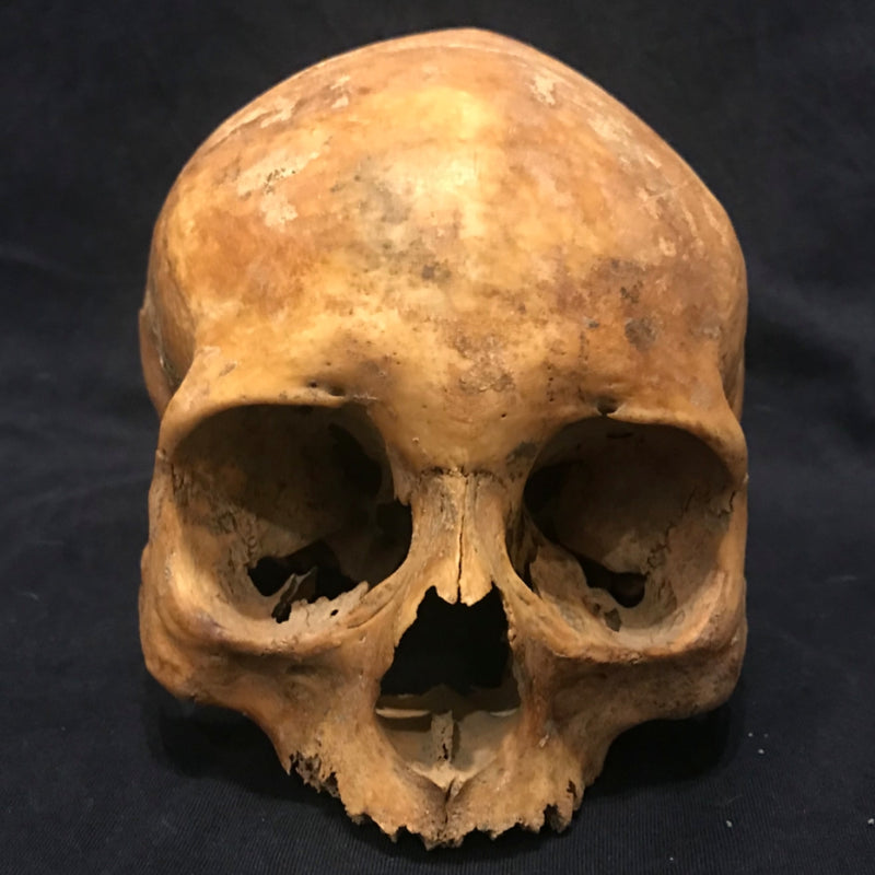 Toulouse Elongated Skull, Medieval