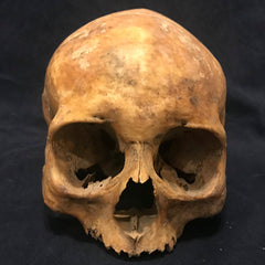 Toulouse Elongated Skull, Medieval