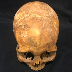 Toulouse Elongated Skull, Medieval