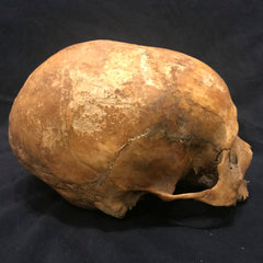 Toulouse Elongated Skull, Medieval
