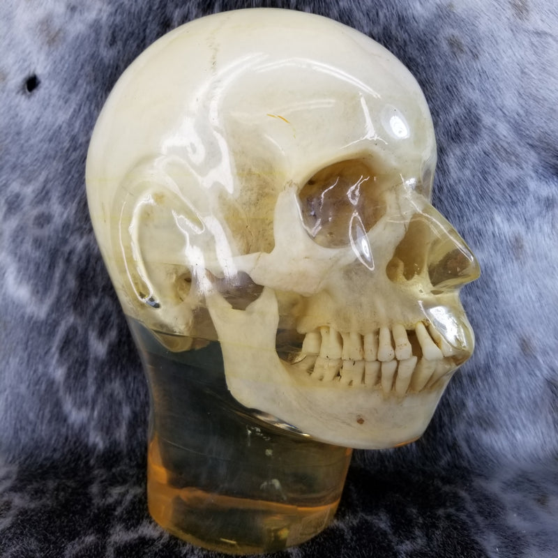 Human Skull, X-RAY Phantom