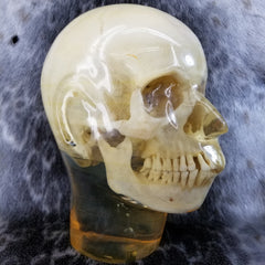 Human Skull, X-RAY Phantom