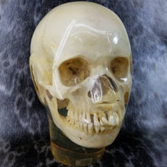 Human Skull, X-RAY Phantom