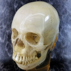 Human Skull, X-RAY Phantom