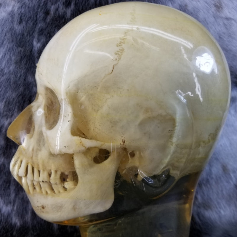 Human Skull, X-RAY Phantom