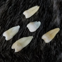 Human Teeth, Molars