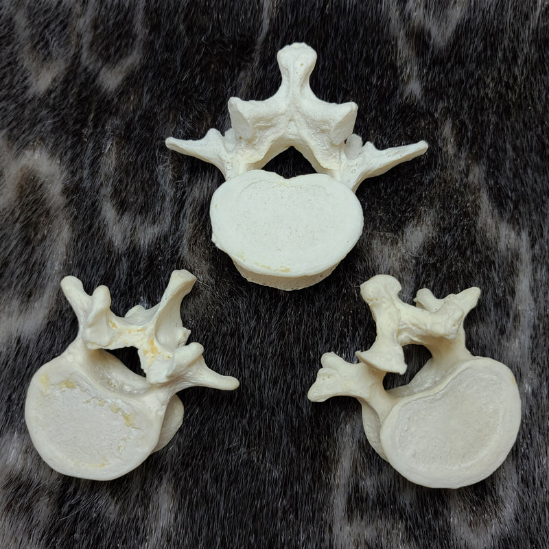 Human Vertebrae, Lumbar