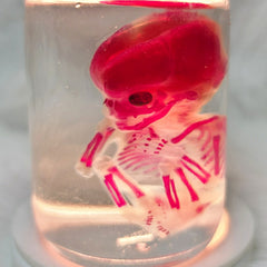 Human Fetus, Diaphonized