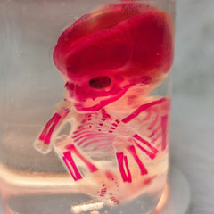 Human Fetus, Diaphonized