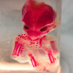 Human Fetus, Diaphonized