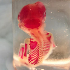 Human Fetus, Diaphonized