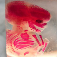 Human Fetus, Diaphonized