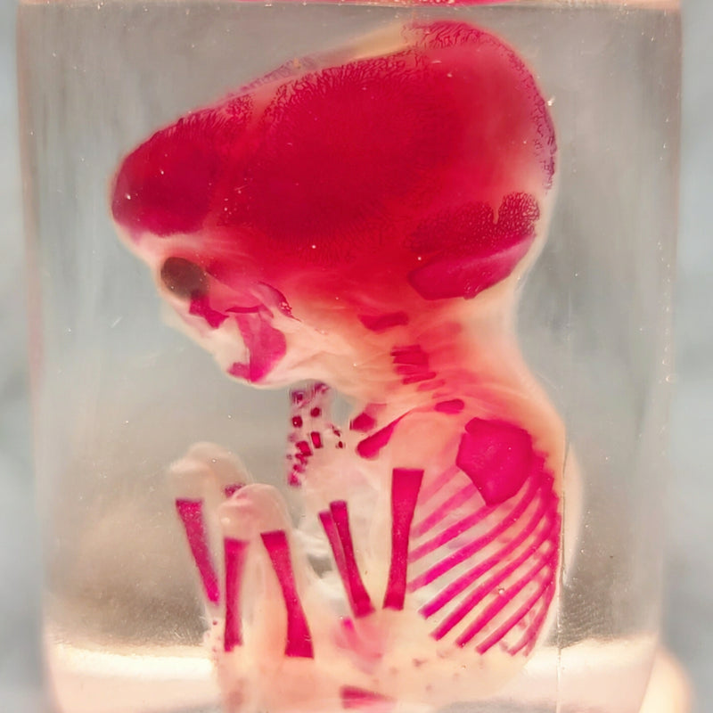 Human Fetus, Diaphonized