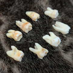 Human Teeth, Molars