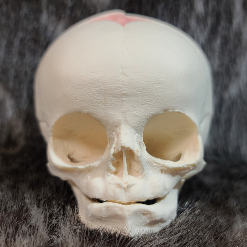 Human Fetal Skull, Cast