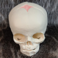 Human Fetal Skull, Cast