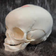 Human Fetal Skull, Cast