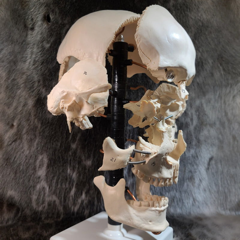 Exploded Human Skull, Beauchene (CAST)