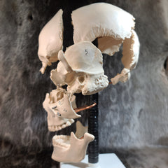 Exploded Human Skull, Beauchene (CAST)