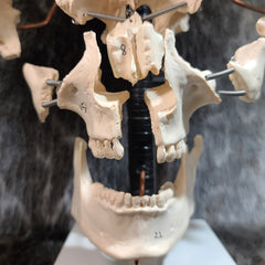 Exploded Human Skull, Beauchene (CAST)