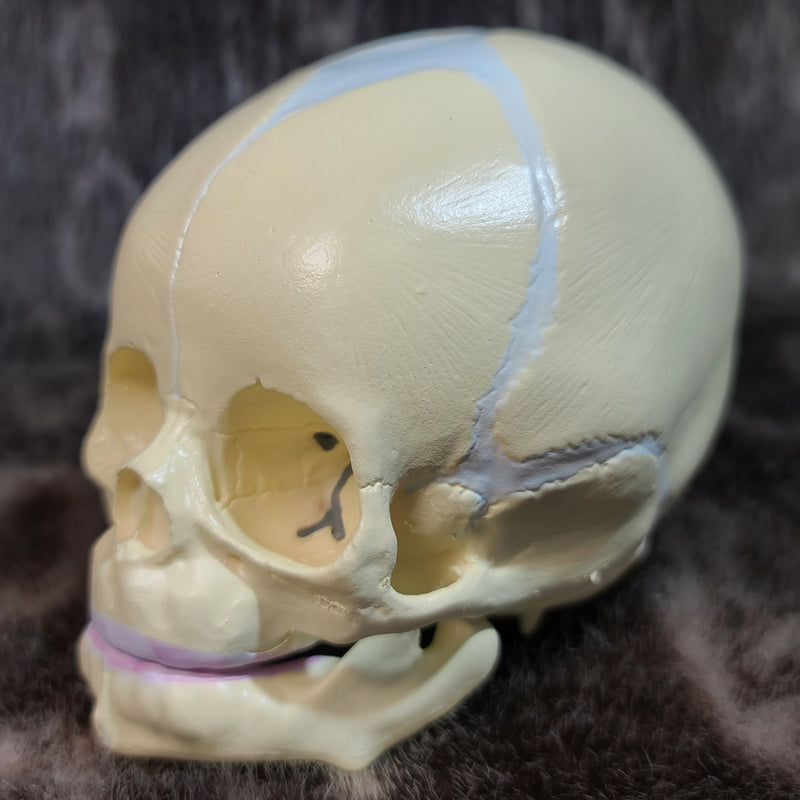 Baby Skull, Cast