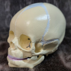 Baby Skull, Cast