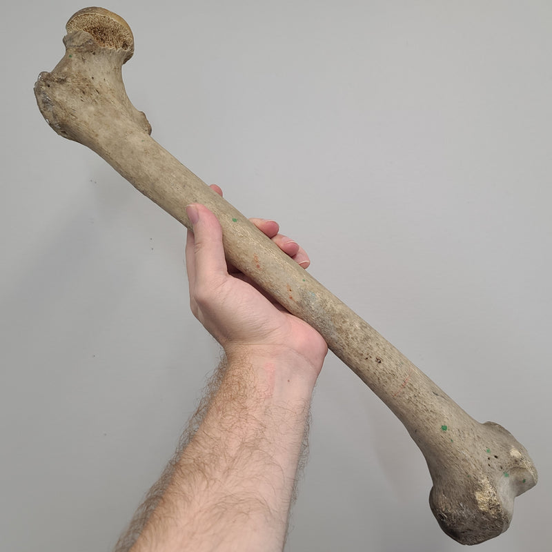 Human Femur Bones