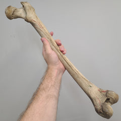 Human Femur Bones