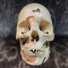 Human Skull, Kilgore Anatomical Preparation