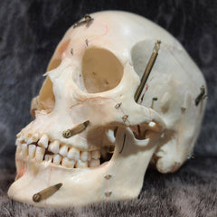 Human Skull, Kilgore Anatomical Preparation