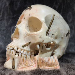 Human Skull, Kilgore Anatomical Preparation