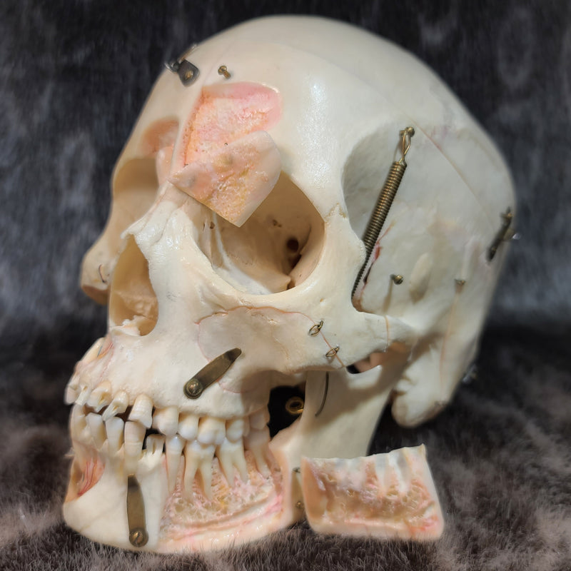 Human Skull, Kilgore Anatomical Preparation