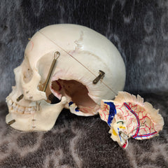 Human Skull, Kilgore Anatomical Preparation